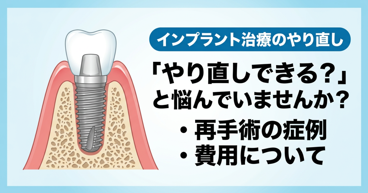 インプラント治療ってやり直しすることはあるの？　再手術になる症例や費用について