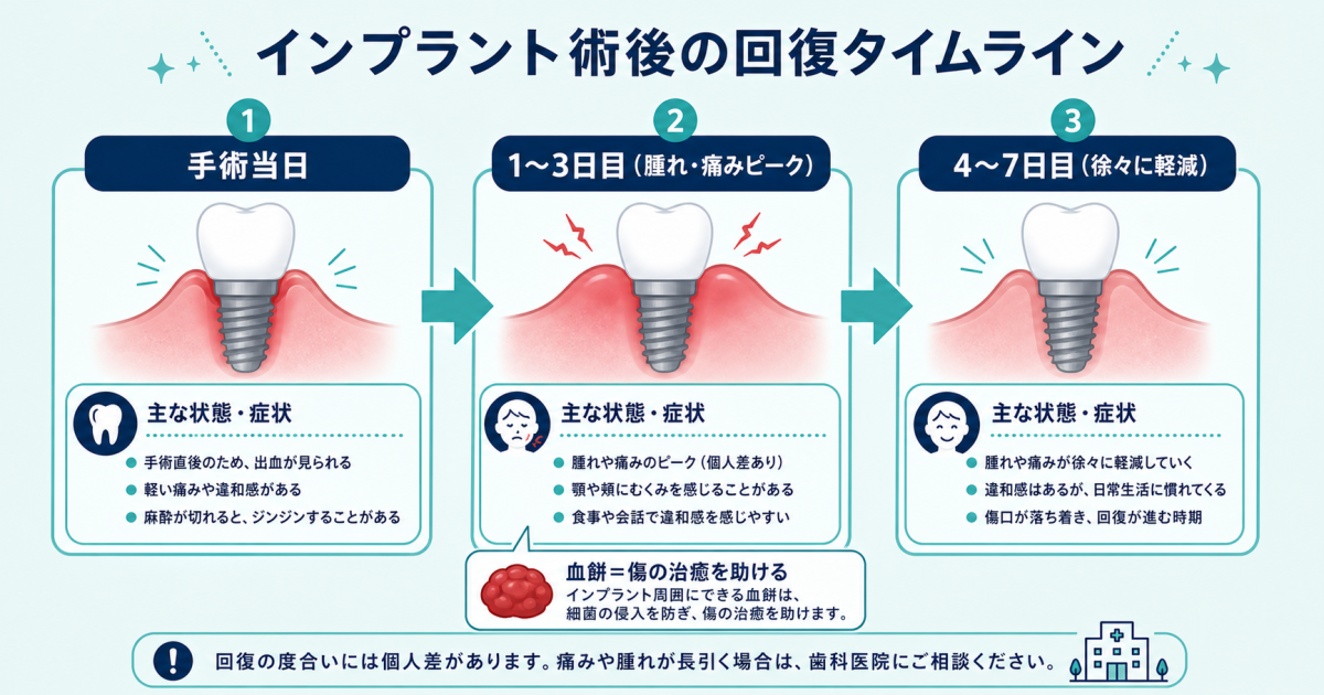 ■インプラント術後の腫れ・痛みはいつまで?正常な回復の目安