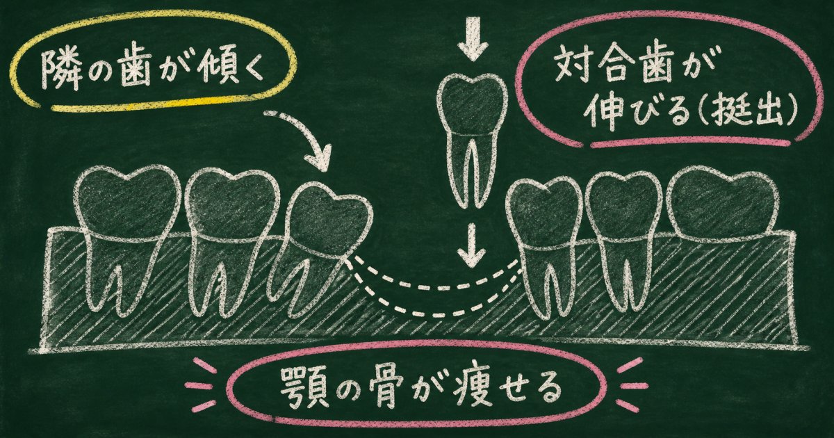 奥歯が1本抜けた放置で生じる口腔内と身体の連鎖的リスク