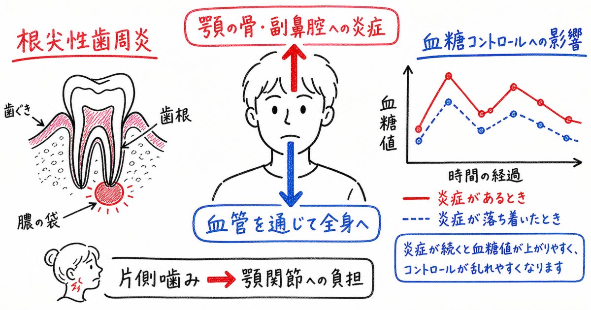 むし歯の放置が口腔内と全身に及ぼす影響